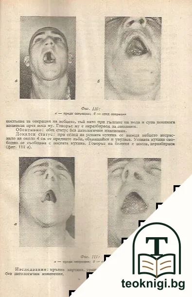 Пластично -възставителната хирургия при ринопластика — снимка 3