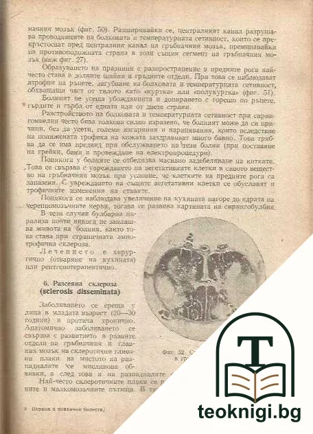 Нервни и психични болести — снимка 4
