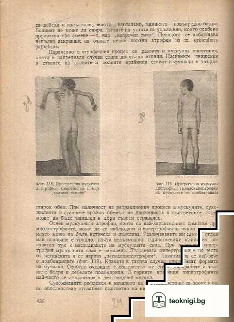 Нервни болести — снимка 4